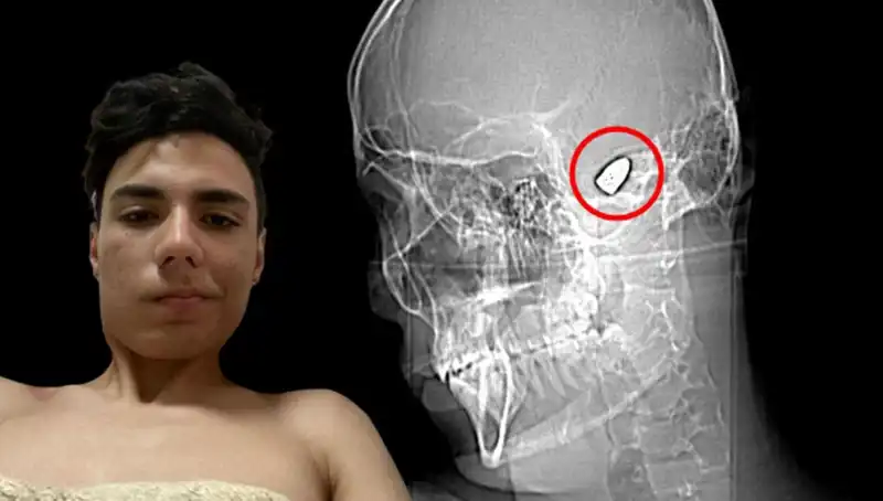 Kafasında Patlayan Düşünceler: Zihin Oyunları ve Psikolojik Gerilim