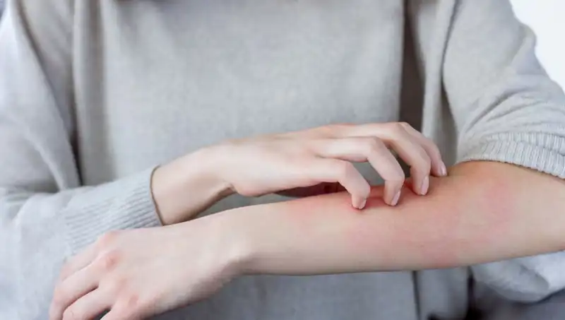 Cilt Kanserinin Alarmı: Dermatologdan Gözden Kaçırılabilecek İki Belirti
