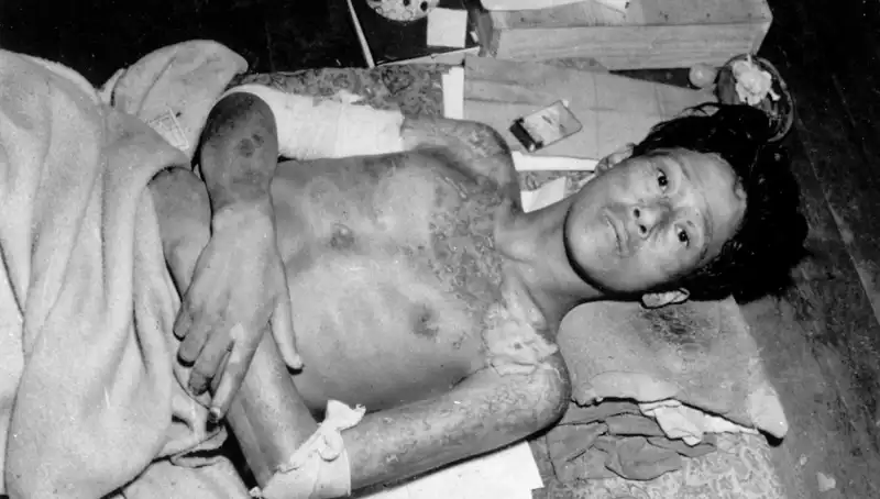 80 Yıl Sonra Nagasaki’den Çarpıcı Uyarı: Nükleer Felaket Kapıda