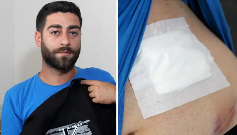 Karnındaki Ağrı Sonrasında Şok Gerçek: Röntgende Neler Ortaya Çıktı?