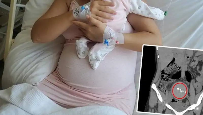 Hastanede Unutulan Bebek: İki Yıl Sonra Gazlı Bez İhmaline Soruşturma