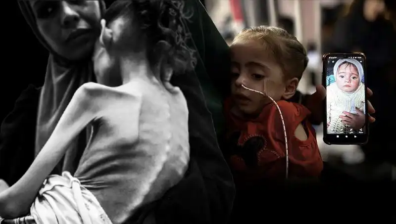 Küçük Meryem'in Mücadelesi: 25 Kilodan 10 Kiloya Düşen Bir Hayat
